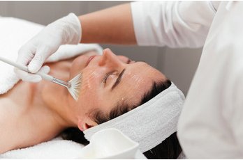 Peeling superficiel à Toulouse