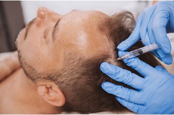 Injections d’A-PRP par méso-needling à Toulouse